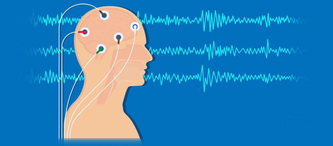 Neurofeedback Technology