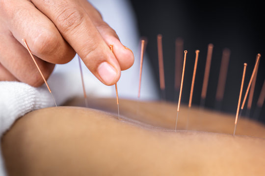 Massage Therapy and Acupuncture