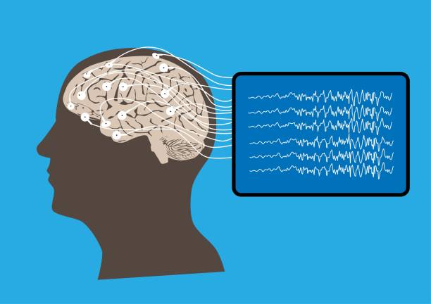 EEG Recording