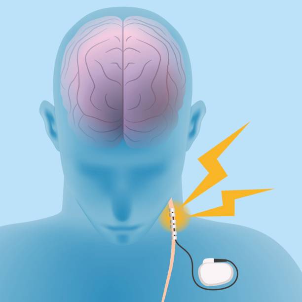 Epilepsy Management